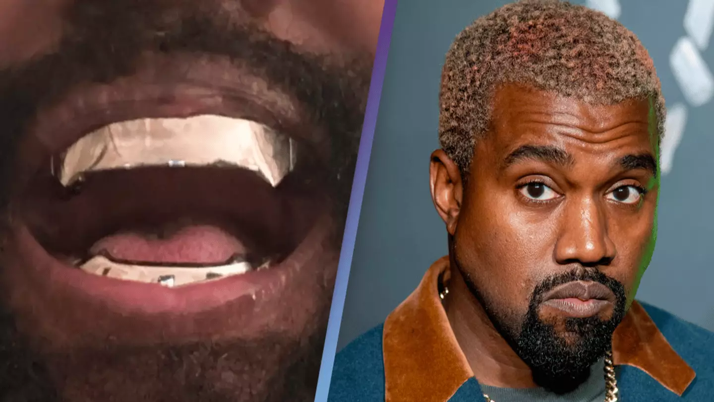 Kanye West Grill Permanent Kanye West Flashes His Shock New 850K Kanye West Grill Permanent Kanye West Flashes His Shock New 850K