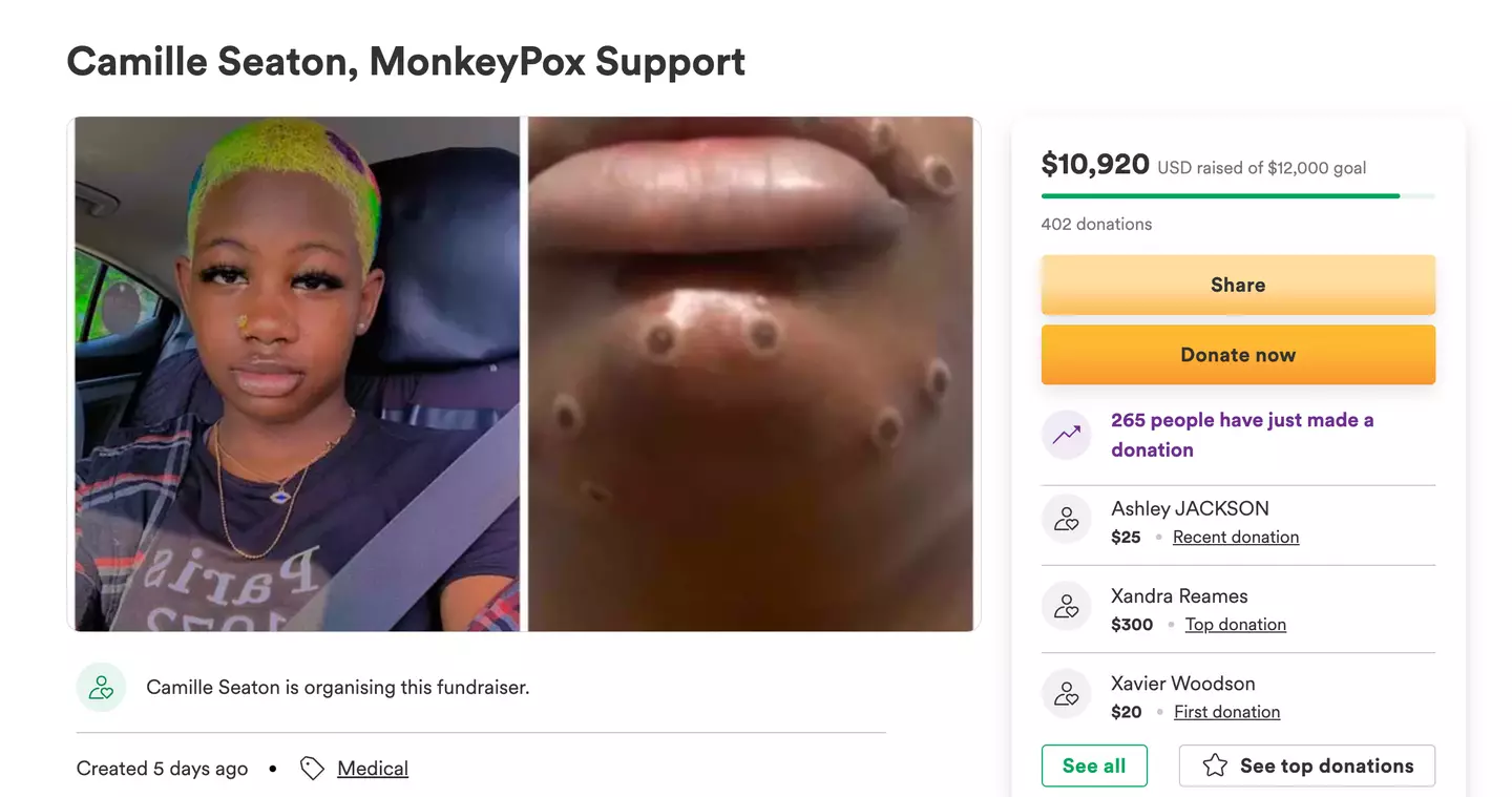 Camille's monkeypox GoFundMe.