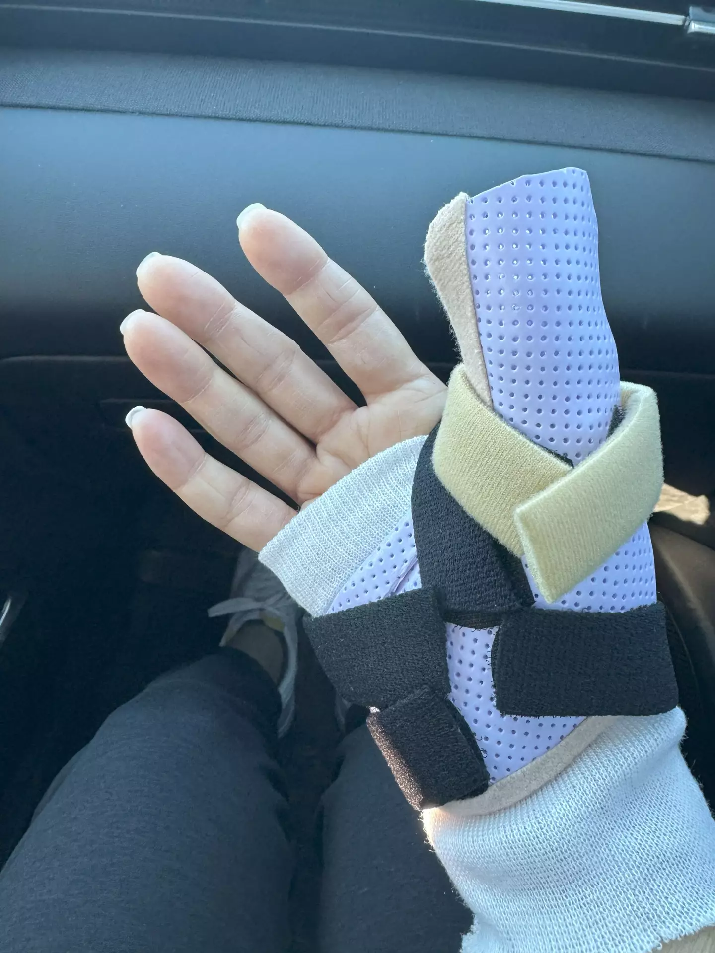 Michelle is sharing her story as a warning (Kennedy News and Media)