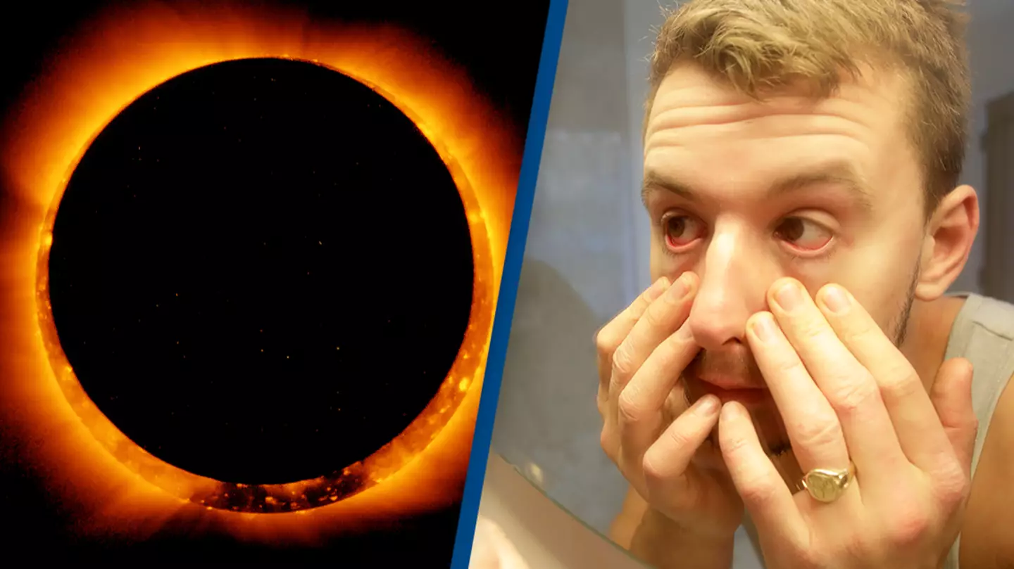 Google searches for 'why do my eyes hurt' skyrocket immediately after solar eclipse
