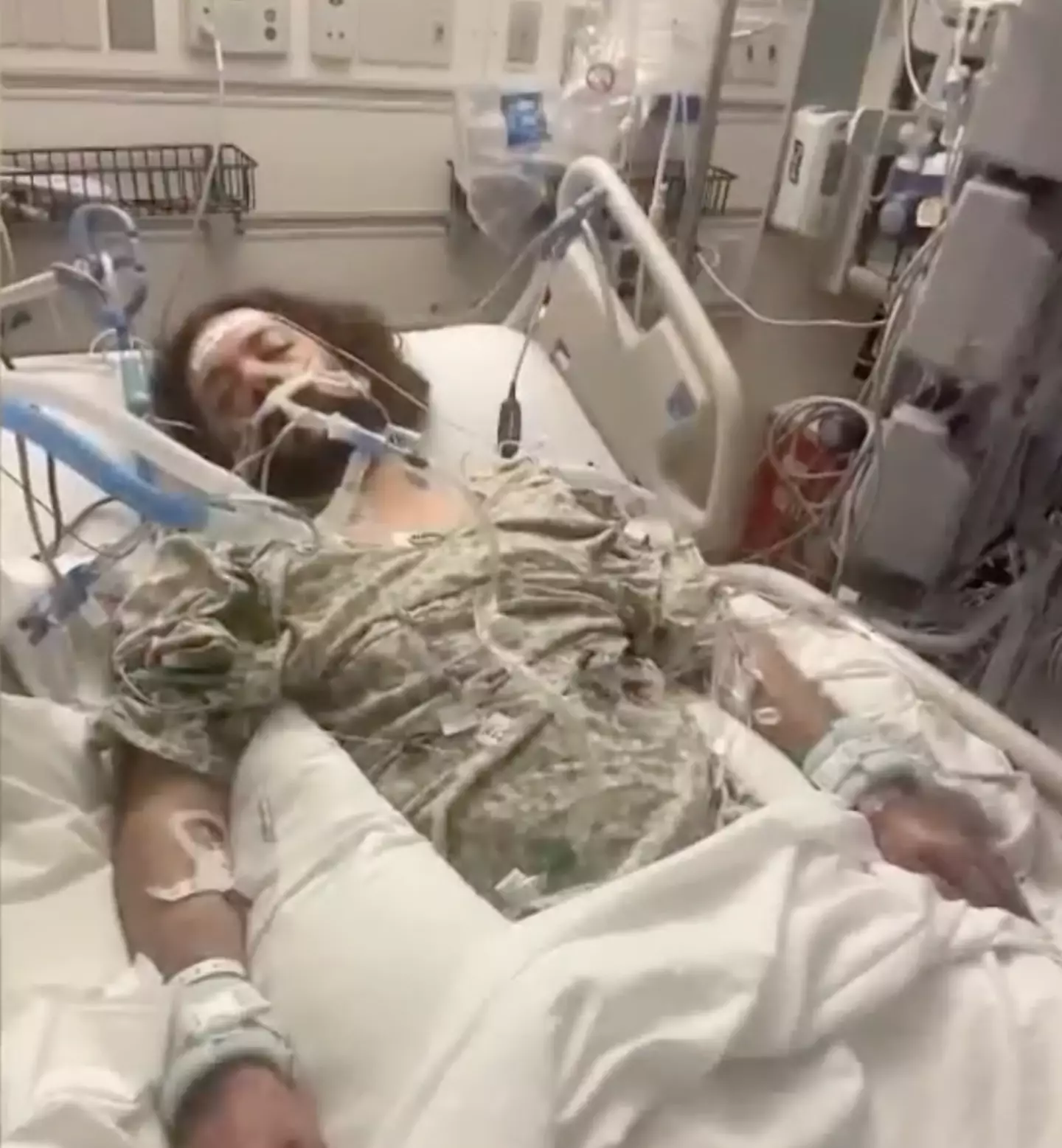 Michael Kohlhof was placed onto a ventilator.