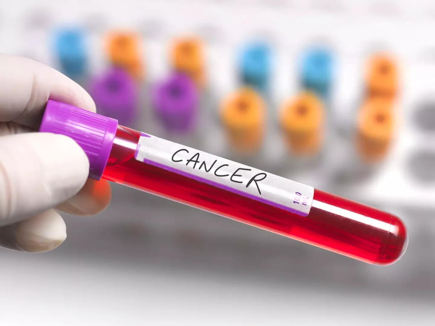 Cancer cases are on the rise (Getty Stock Photo)