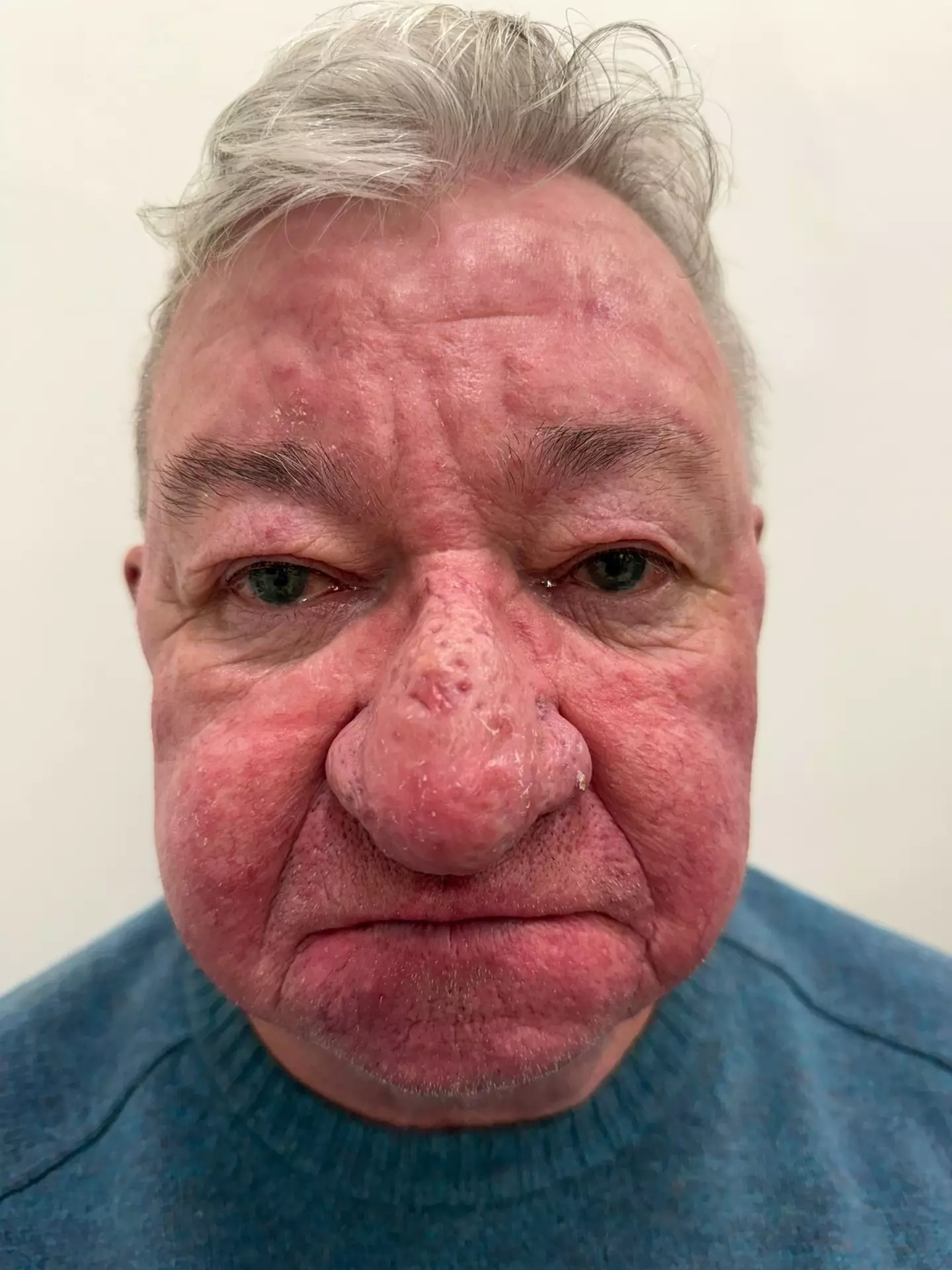 After the life changing operation, Gerard says he finally feels like himself again (Kennedy News and Media/Ever Clinic)