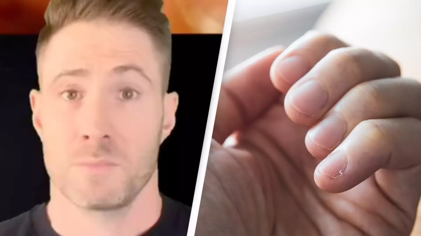 The small detail in your fingernails that means you may be at risk of sudden death