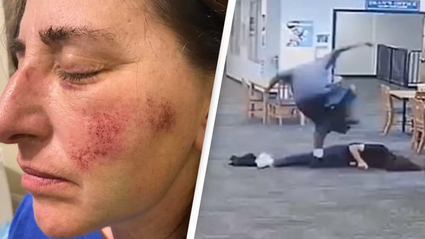 Teacher beaten unconscious by student after stopping him playing video games says she's forced to live off donations