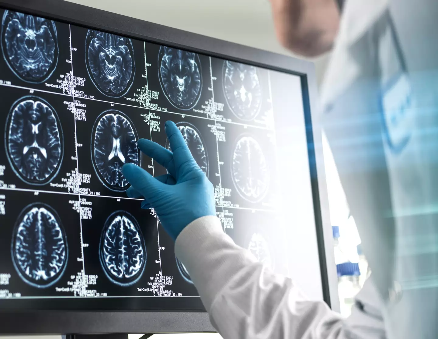 Scientists monitored the brain activity of four dying patients to see these results. (Getty Stock Photo)