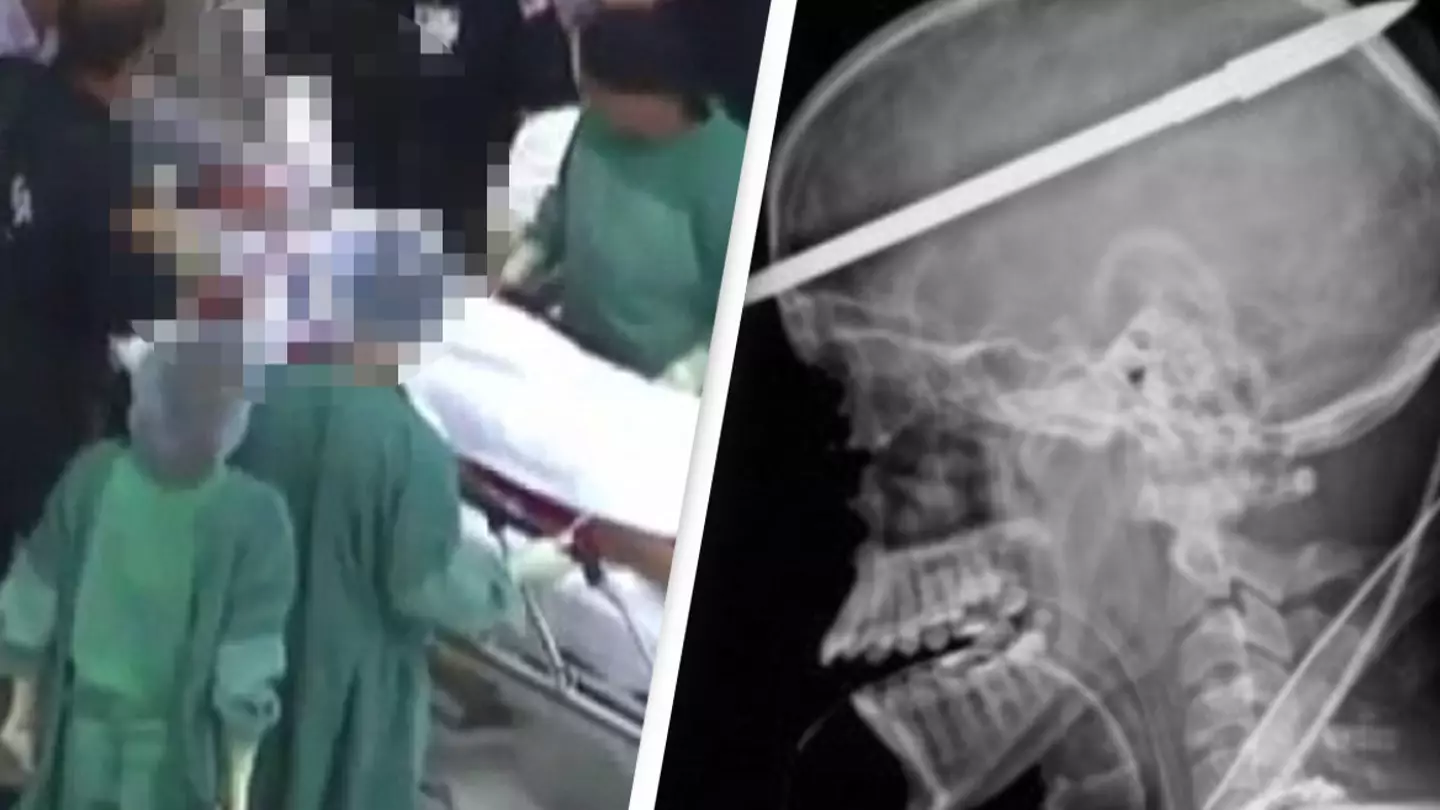 Teen who shot himself through the head with a spear gun miraculously lived to tell the tale