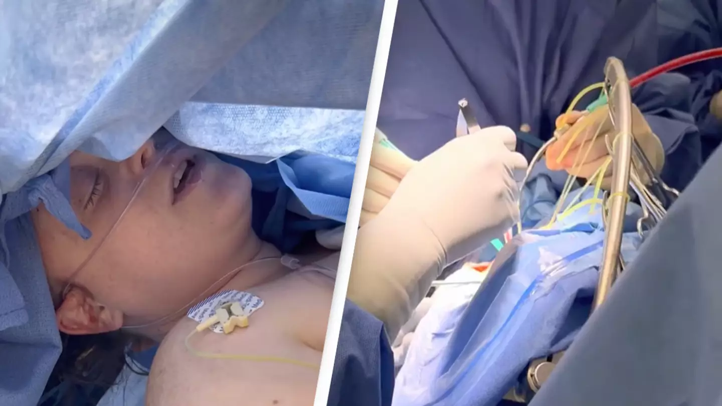 Patient undergoing brain surgery sings Moana while tumour is removed
