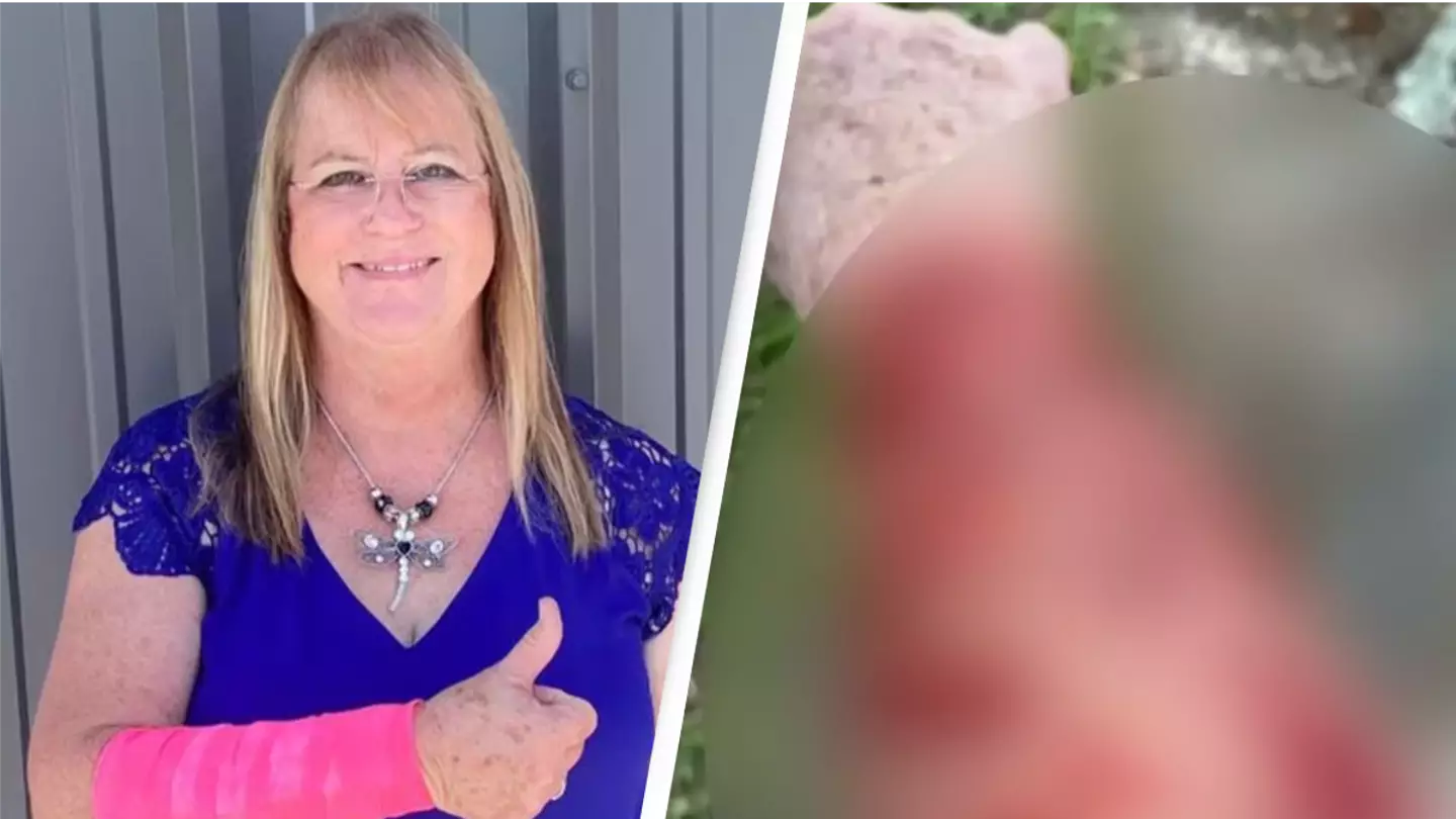World’s unluckiest woman attacked by snake that fell out of sky before hawk starts assaulting her too