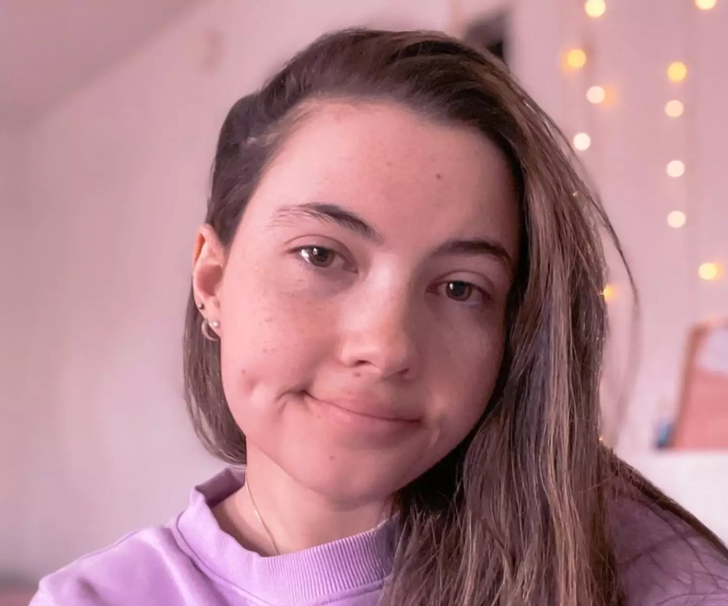 Tessa takes medication to alleviate rashes from water.