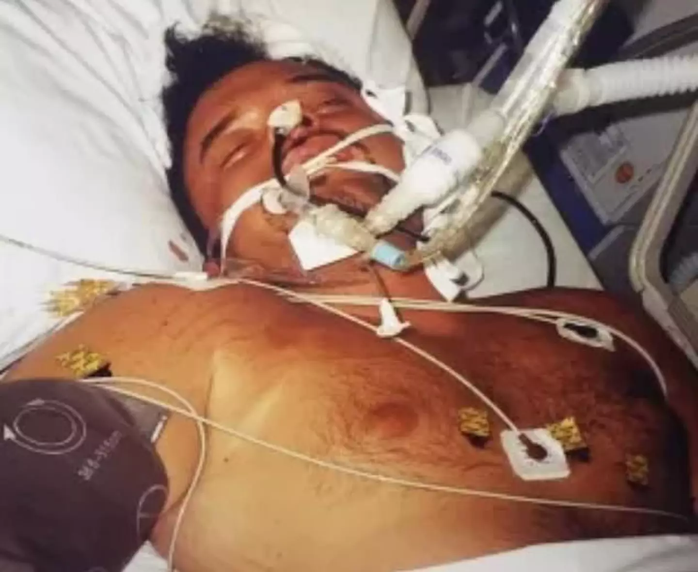 He was placed on life support (Submitted)