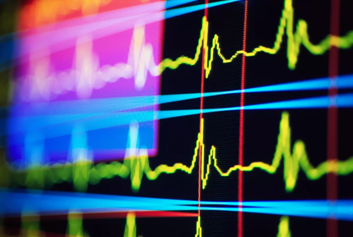The claims that he 'flatlined' before going into a two month-long coma (Getty Stock)