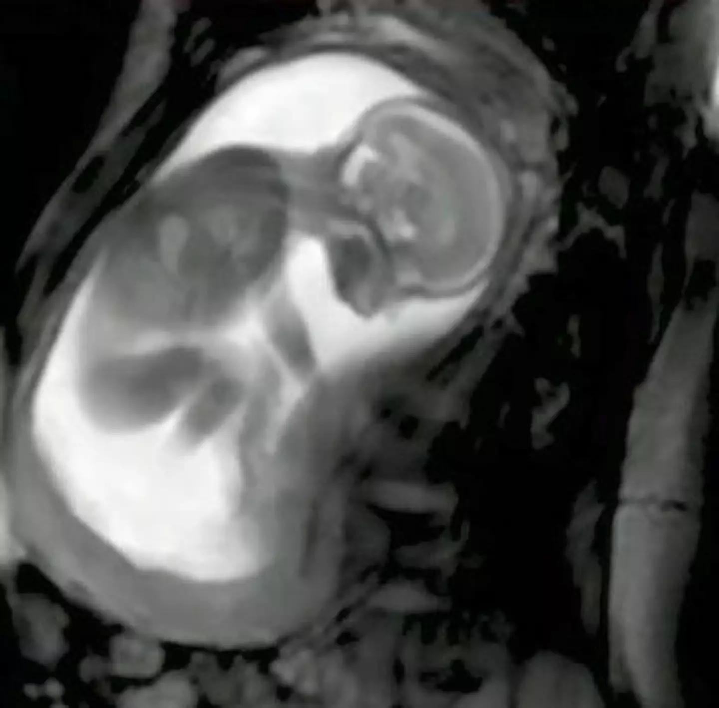 The scan, which reportedly took place in 2017, was recorded by the iFIND project, a London-based group of medical experts.