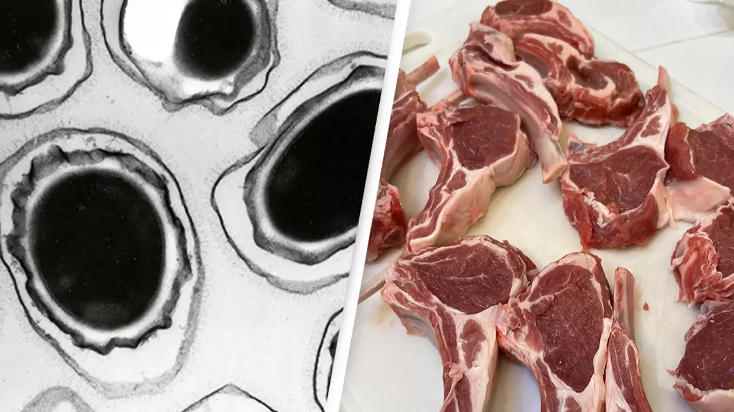 Anthrax Vaccine Immunization Program/Getty Images/Smith Collection/Gado/Getty Images