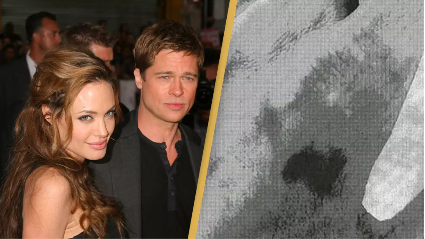 FBI photos of Angelina Jolie's alleged bruises after Brad Pitt fight released