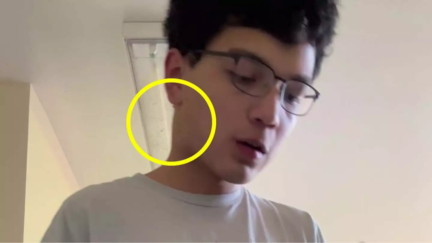 Student claims TikTok saved his life after noticing concerning symptom while taking part in online trend