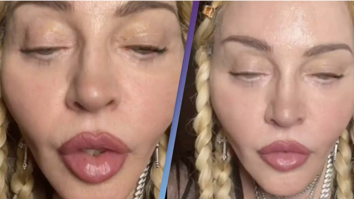 Madonna's 'Weird' TikTok Leaves Fans Worried