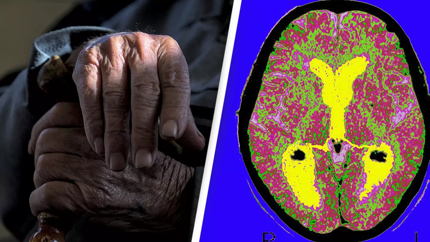 New drug found to slow Alzheimer’s and is being praised as a ‘turning point’ in fight against the disease