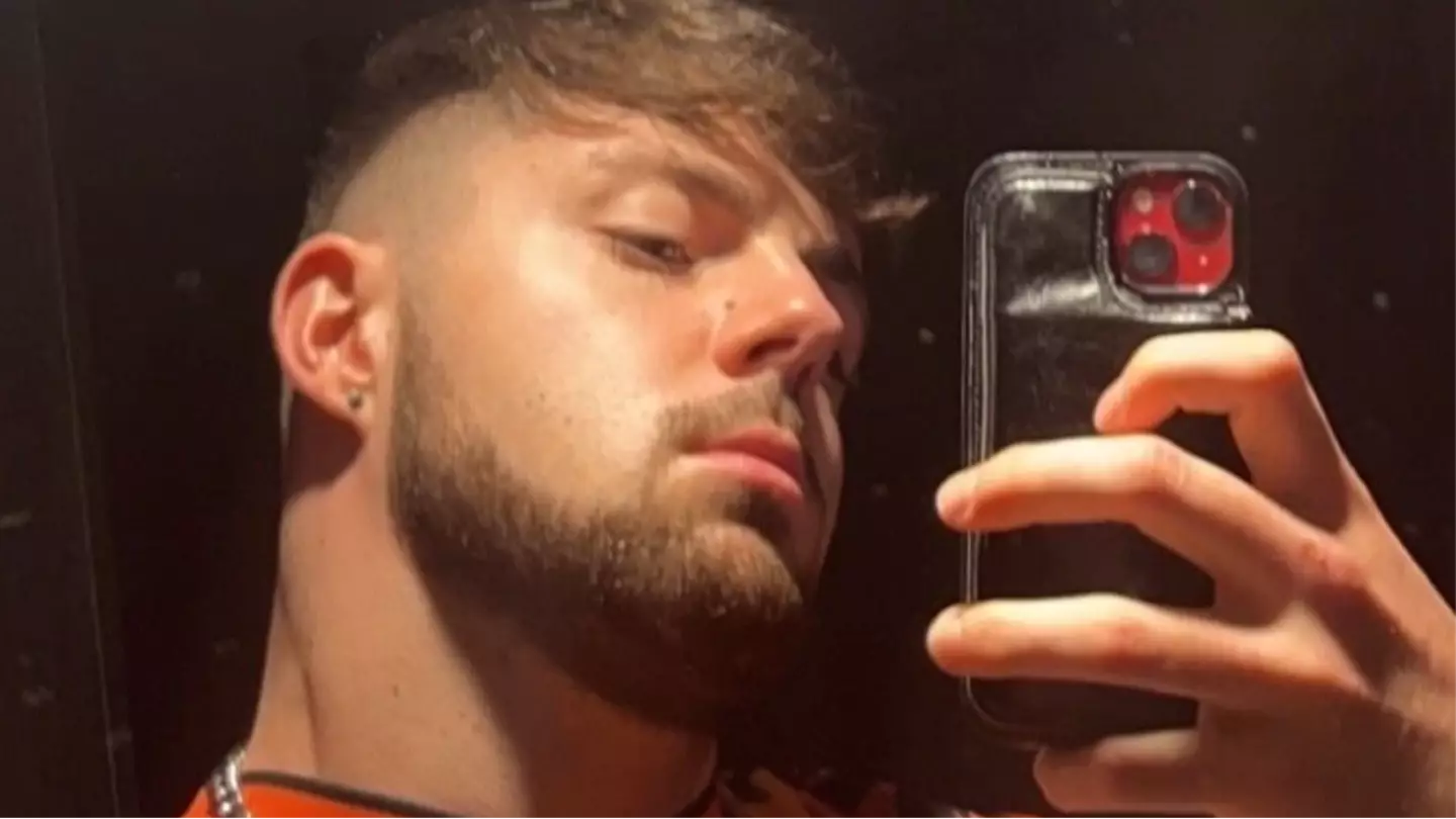 Man issues major warning after ignoring 'no sex' rule following hair transplant surgery
