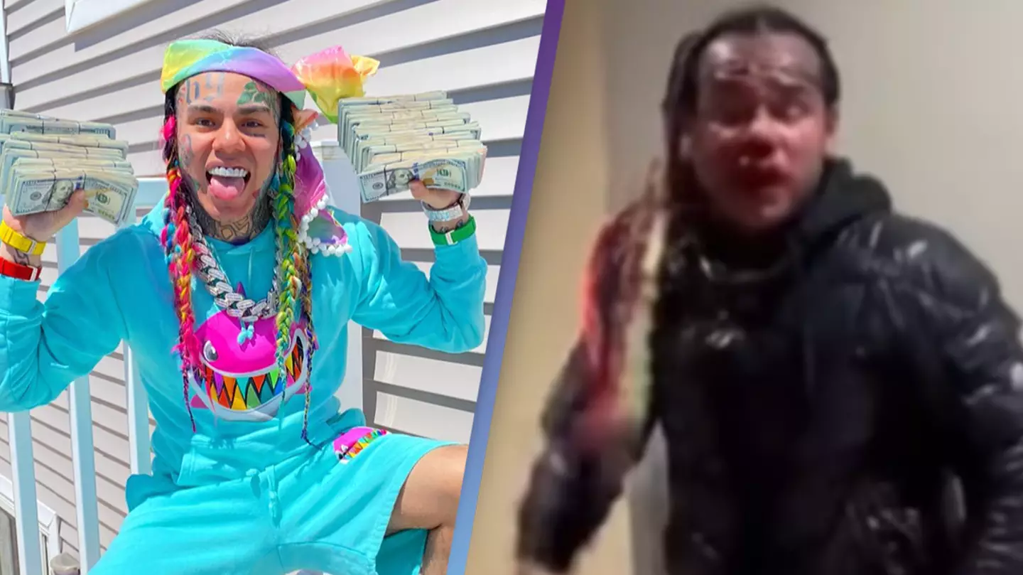 Tekashi 6ix9ine breaks silence for first time since being brutally attacked
