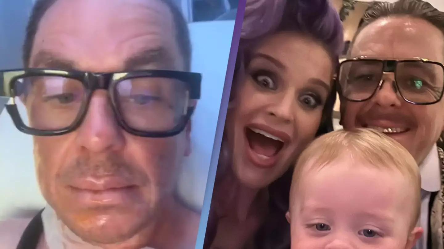 Kelly Osbourne’s boyfriend recalls watching his skin peel away as he drove to ER following horrifying accident