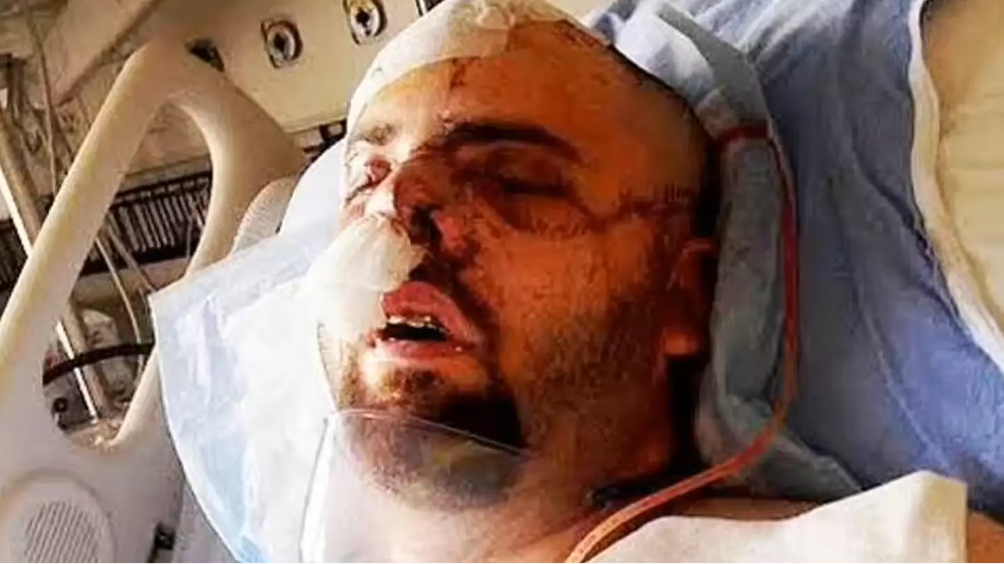 Man who survived grizzly bear attack explains how 'Baby Shark' song saved his life