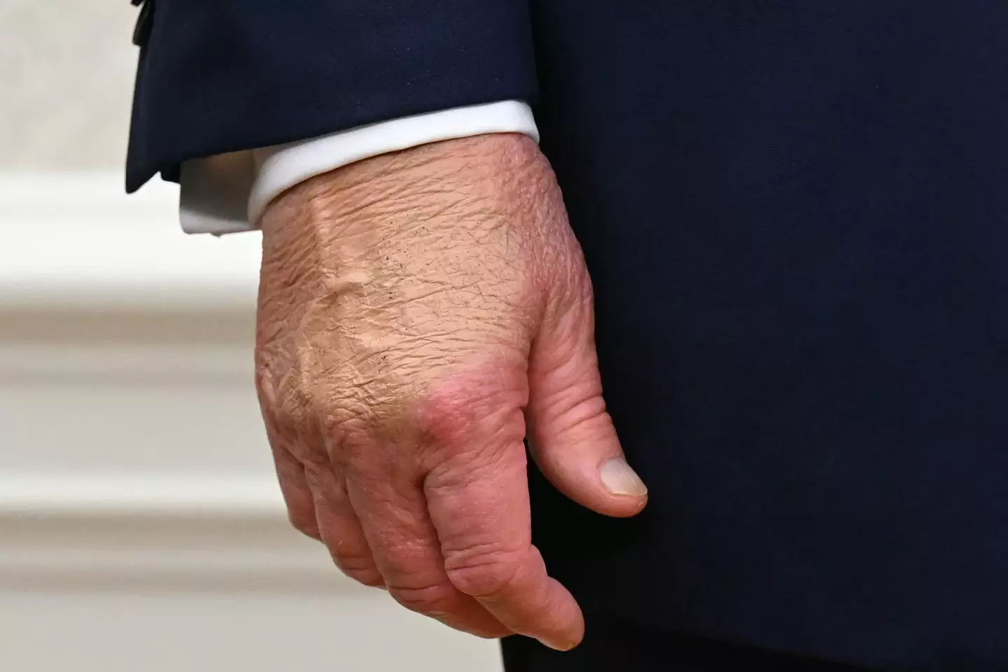 The president's health has been in the headlines in recent months (SAUL LOEB/AFP via Getty Images)