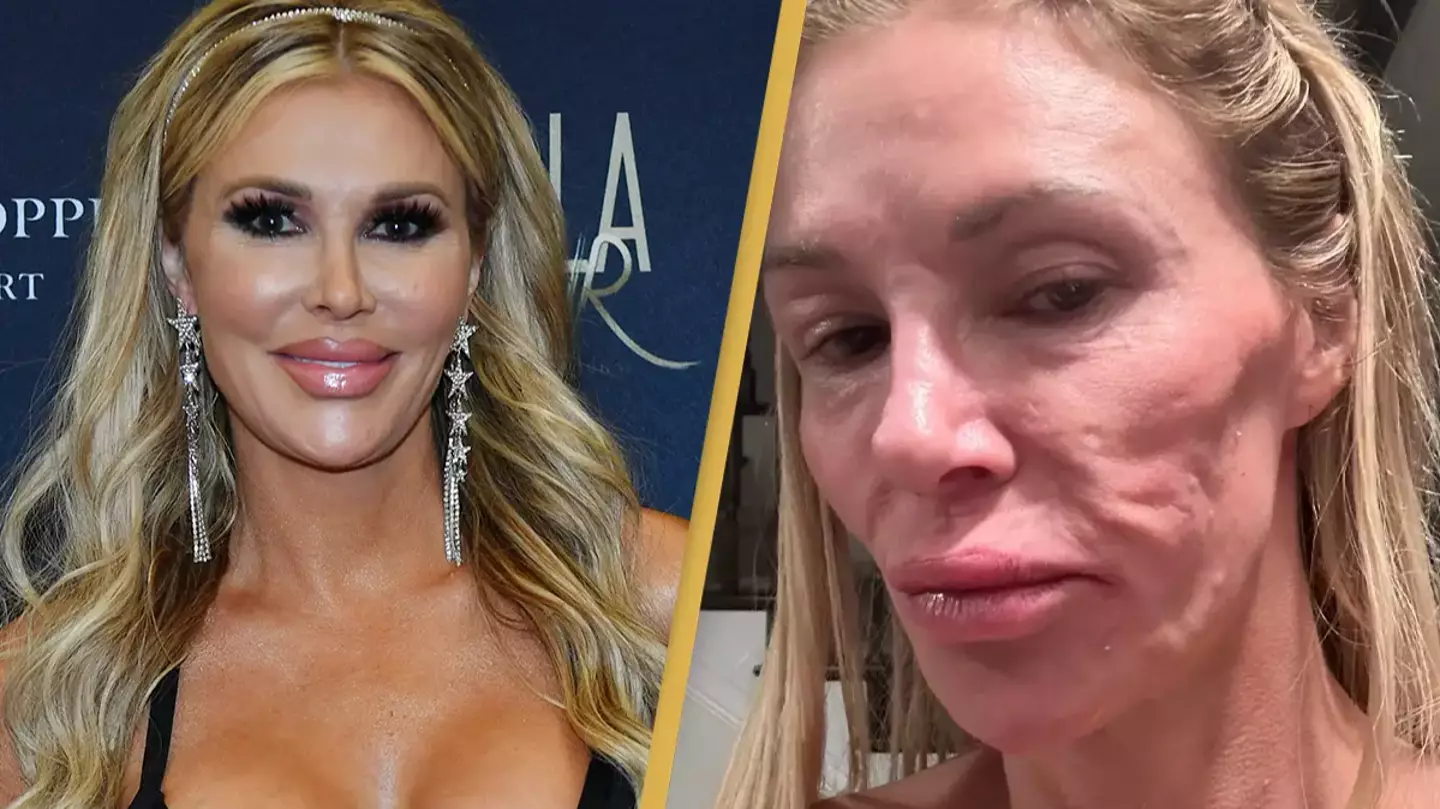 Brandi Glanville speaks out amid comments from doctor on 'parasite' that's caused her to lose five teeth and $70,000
