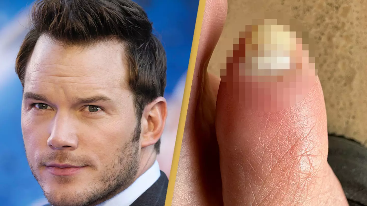 Fans are absolutely disgusted after Chris Pratt uploaded a rogue photo of his toe