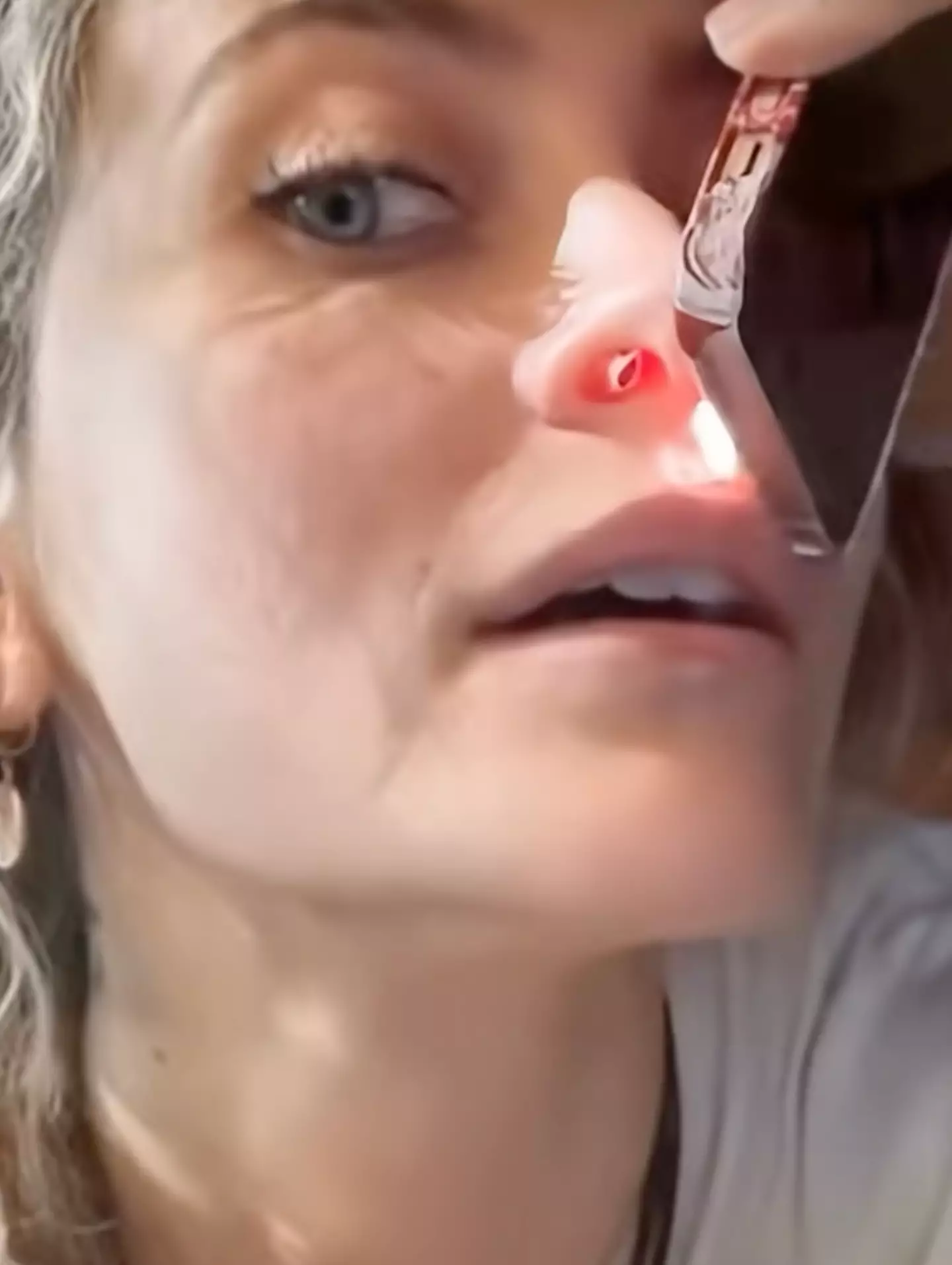 The singer opened up about the condition (TikTok)