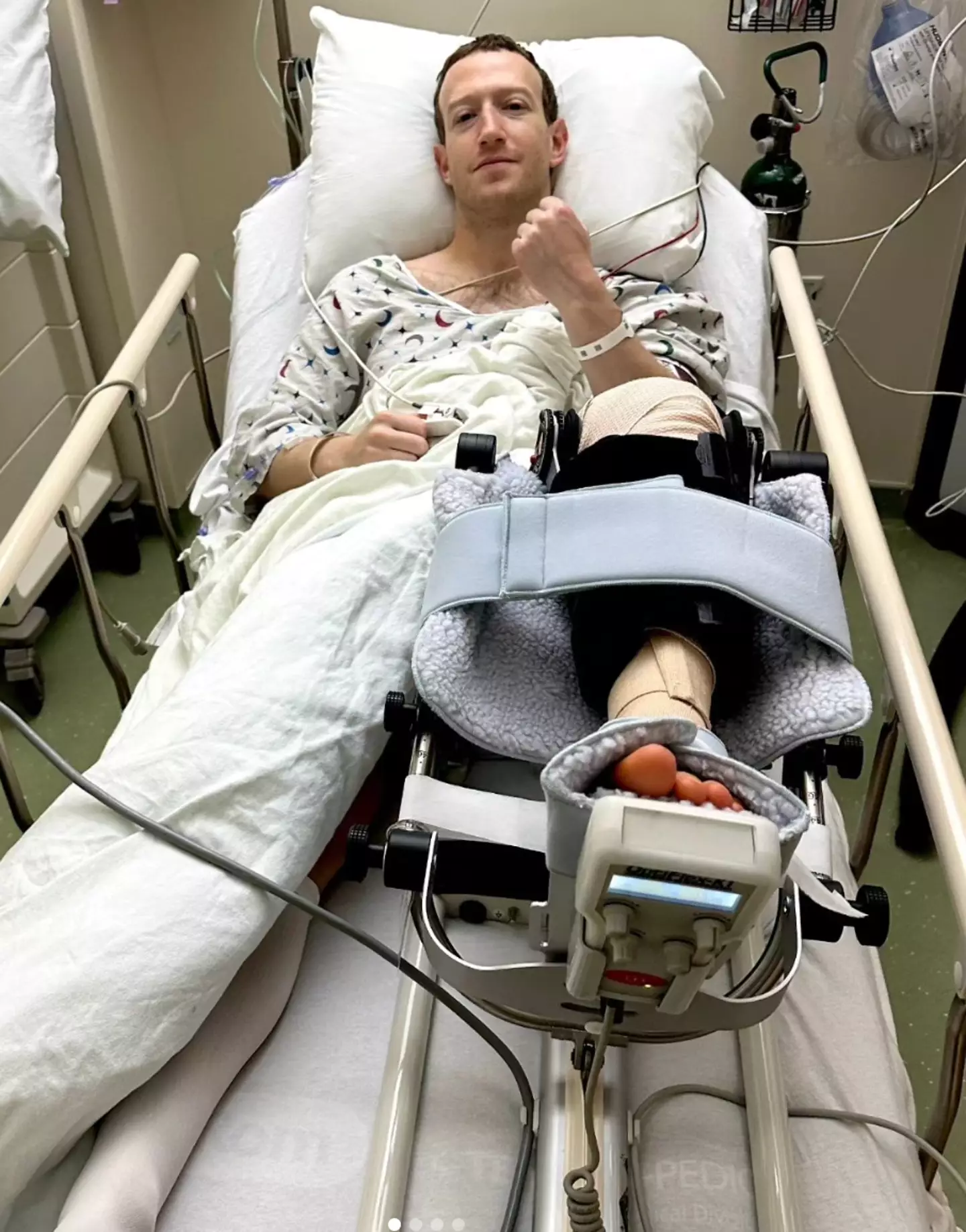 Mark Zuckerberg has sustained a leg injury.