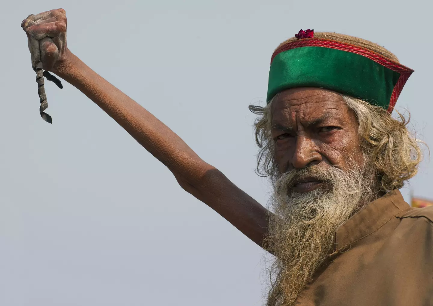 Amar Bharati can no longer bend his arm. (Eric LAFFORGUE/Gamma-Rapho via Getty Images)
