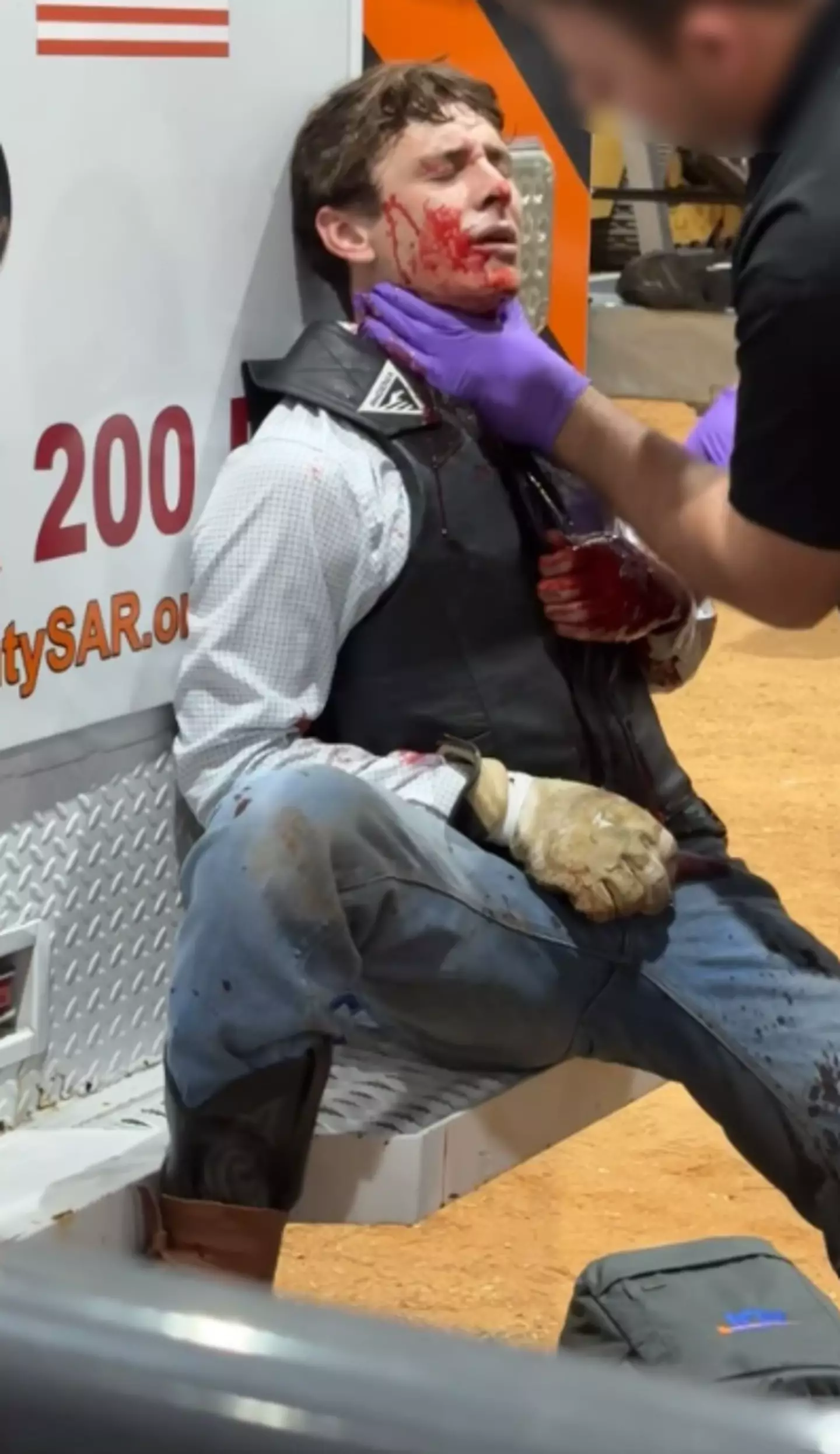 At first, he thought he had only been scratched until he saw the blood (Kennedy News and Media)