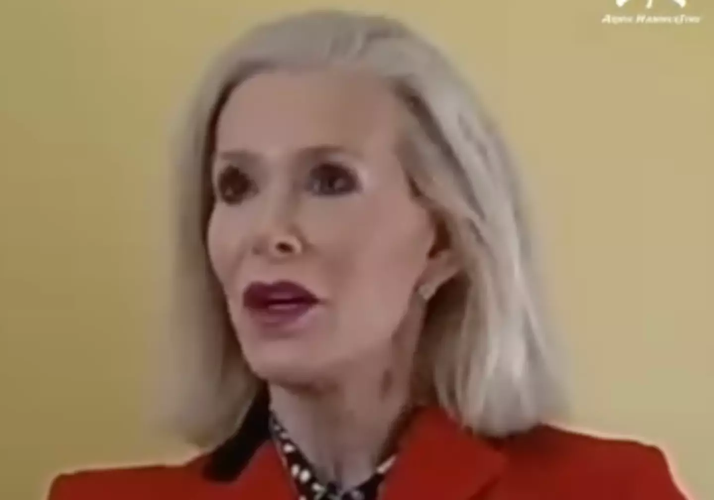 Dru was happy to pay for the procedure (Instagram/@armiehammertime)