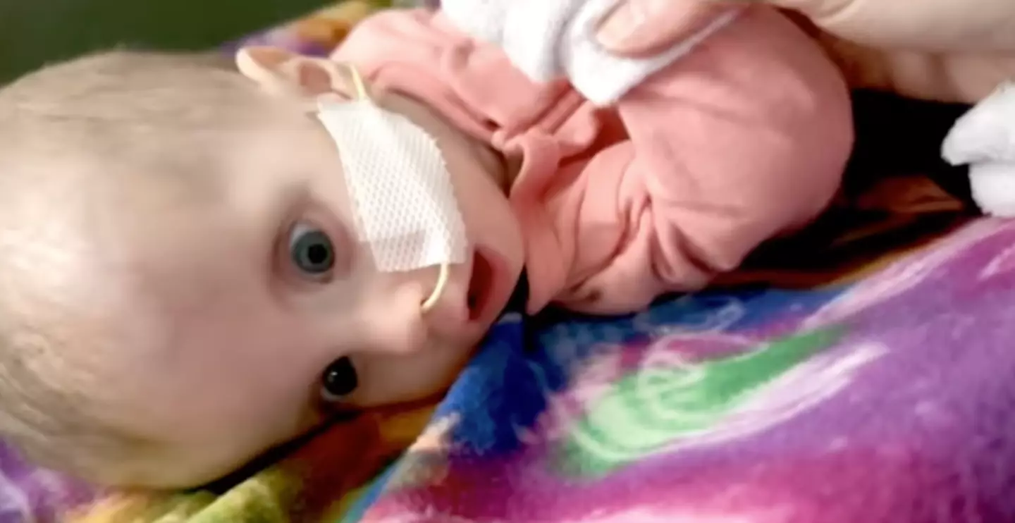 Hazel can't close her eyes (Fox News)