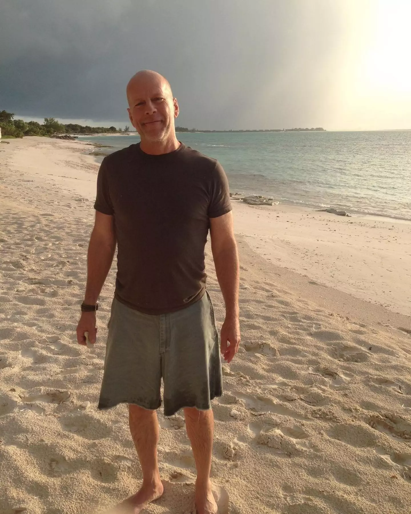 Bruce Willis has been diagnosed with frontotemporal dementia.