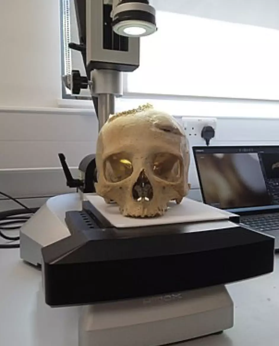 Researchers could not quite believe what they discovered. (Tondini, Isidro, Camarós, 2014)