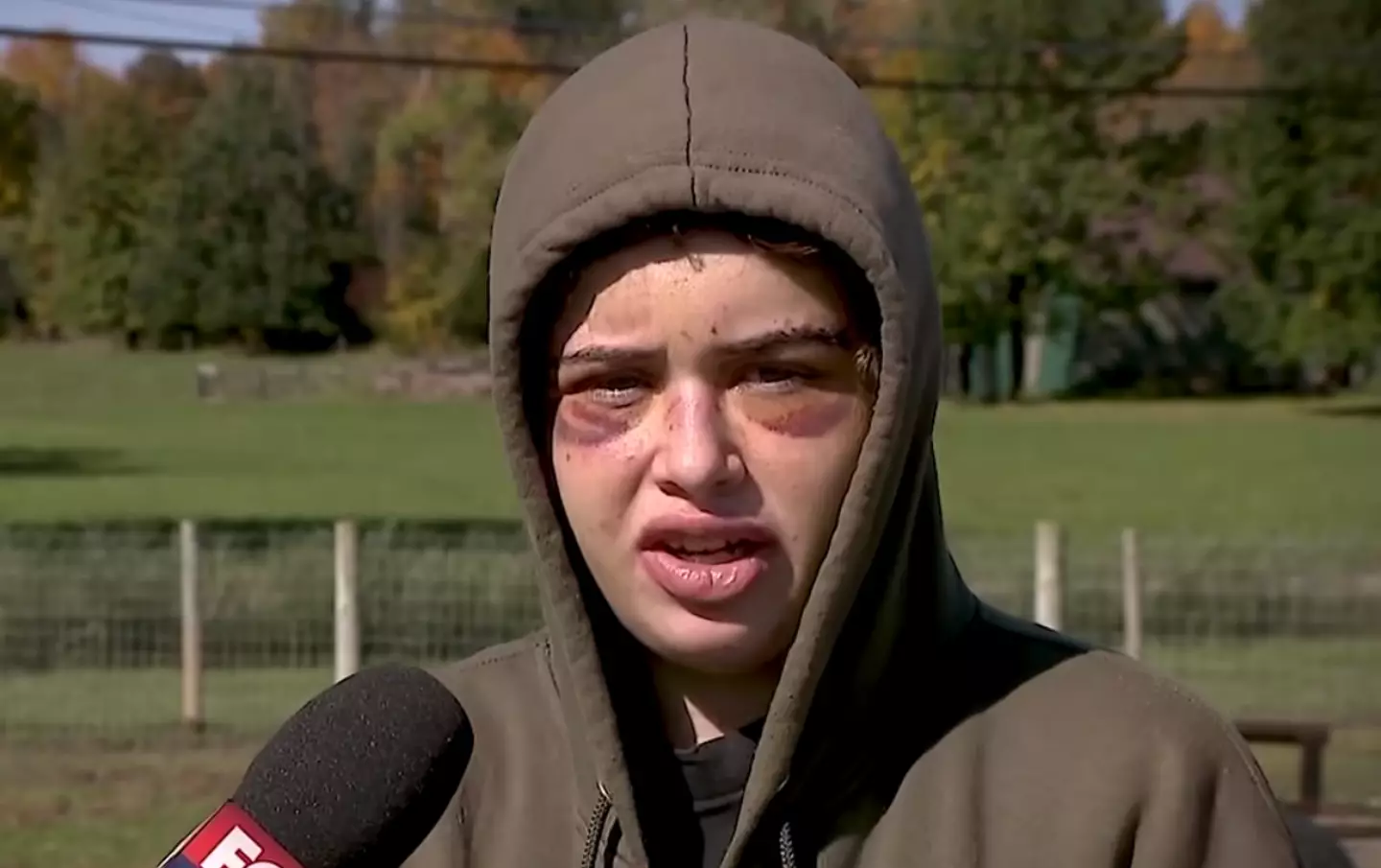 Chloe Jones is reported as having suffered a skull fracture.