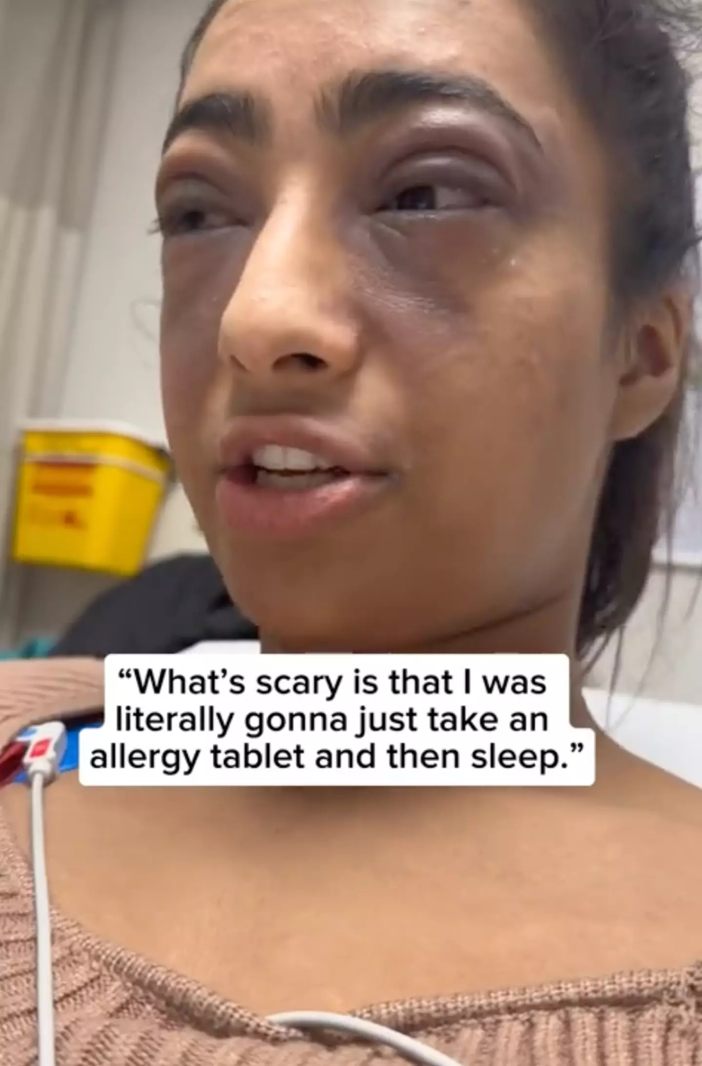 Sewlal's reaction was nearly life threatening.