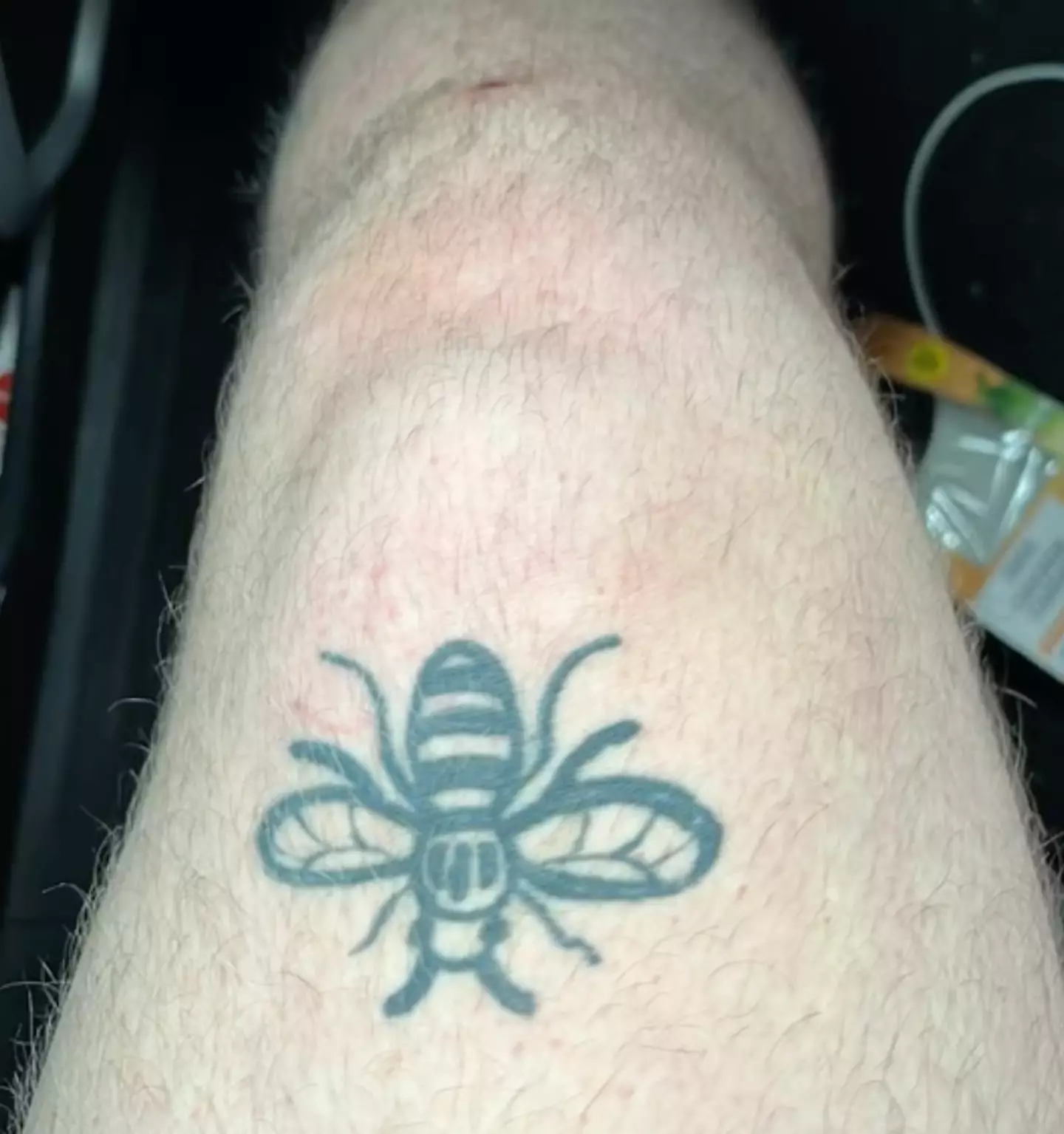 Horrifically Dan Jones' kneecap can be seen in his thigh (TikTok/@danj3903)
