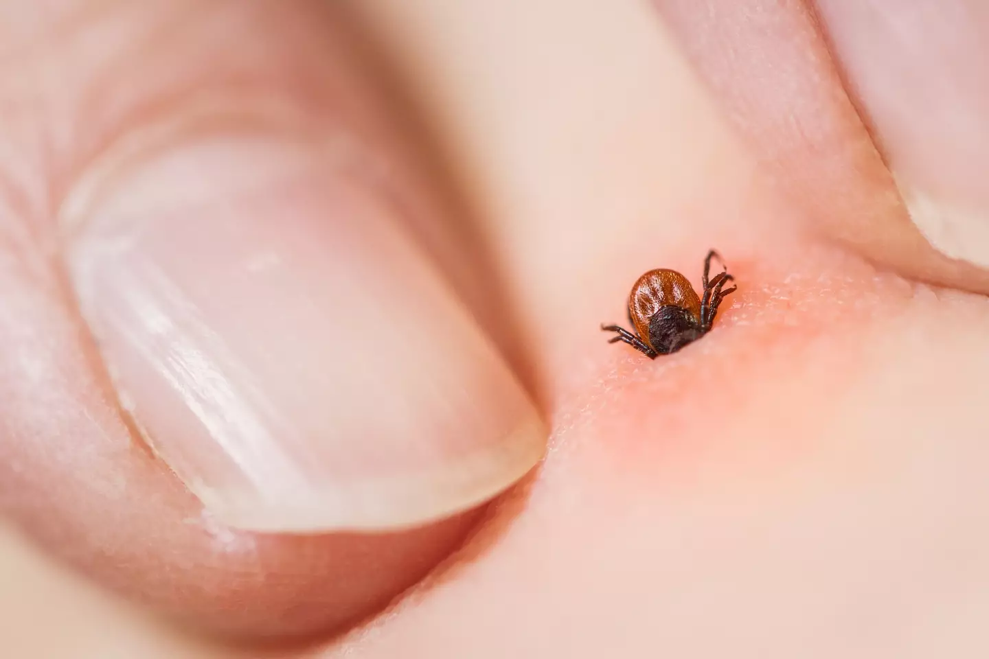 Ticks can infect people with Lyme disease (Getty Images)