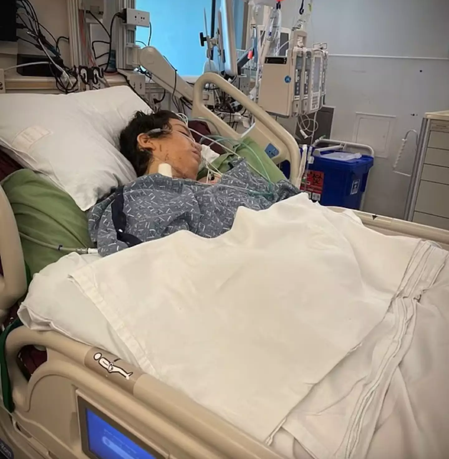 Ariana Pulido died six times when she was about to undergo surgery to remove a tumor (Family Handout)