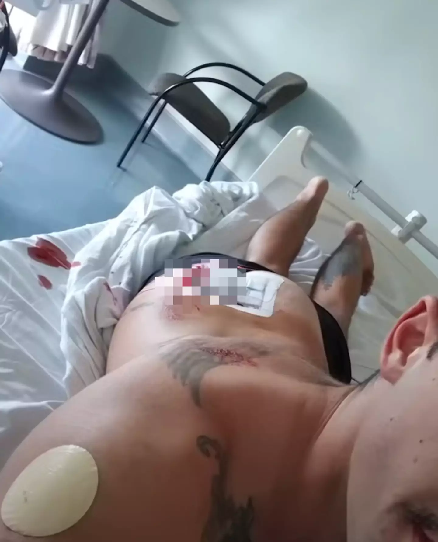 As of 2022, Dylan had been operated on nine times (ABC Science/YouTube)