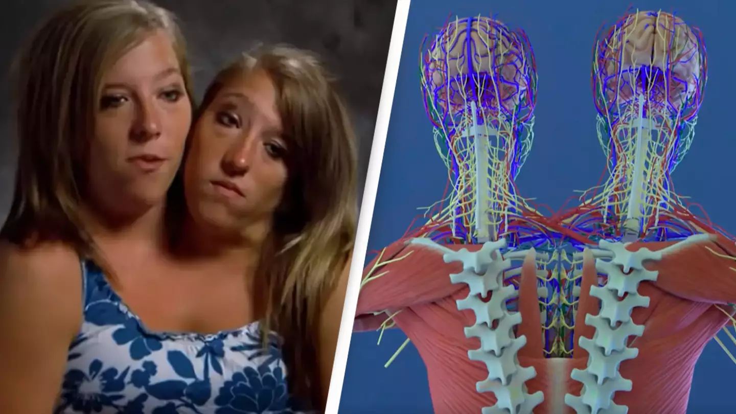 Incredible simulation shows conjoined twins Abby and Brittany Hensel's 'unique' anatomies and how they function