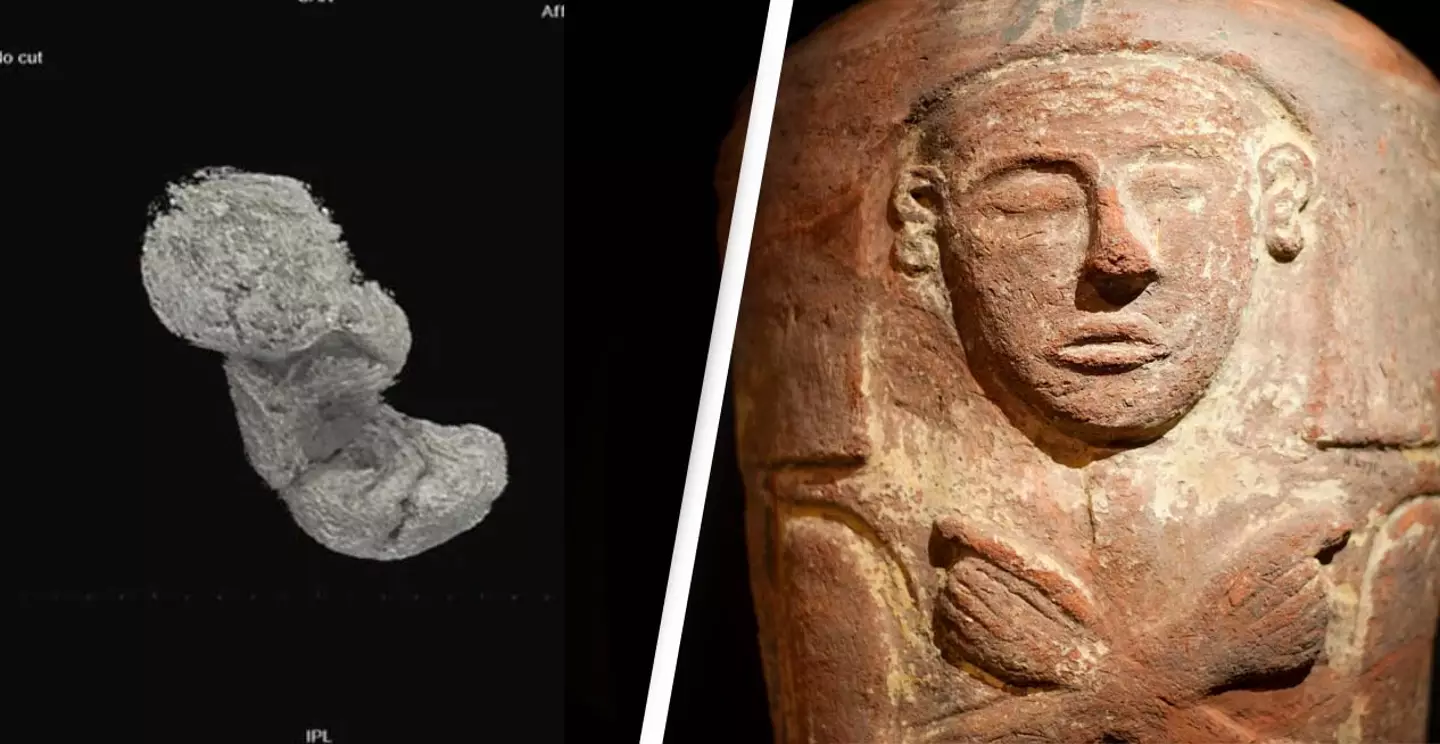 2000-Year-Old Foetus Discovered In Egyptian Mummy's Abdomen (Warsaw Mummy Project/Alamy) 