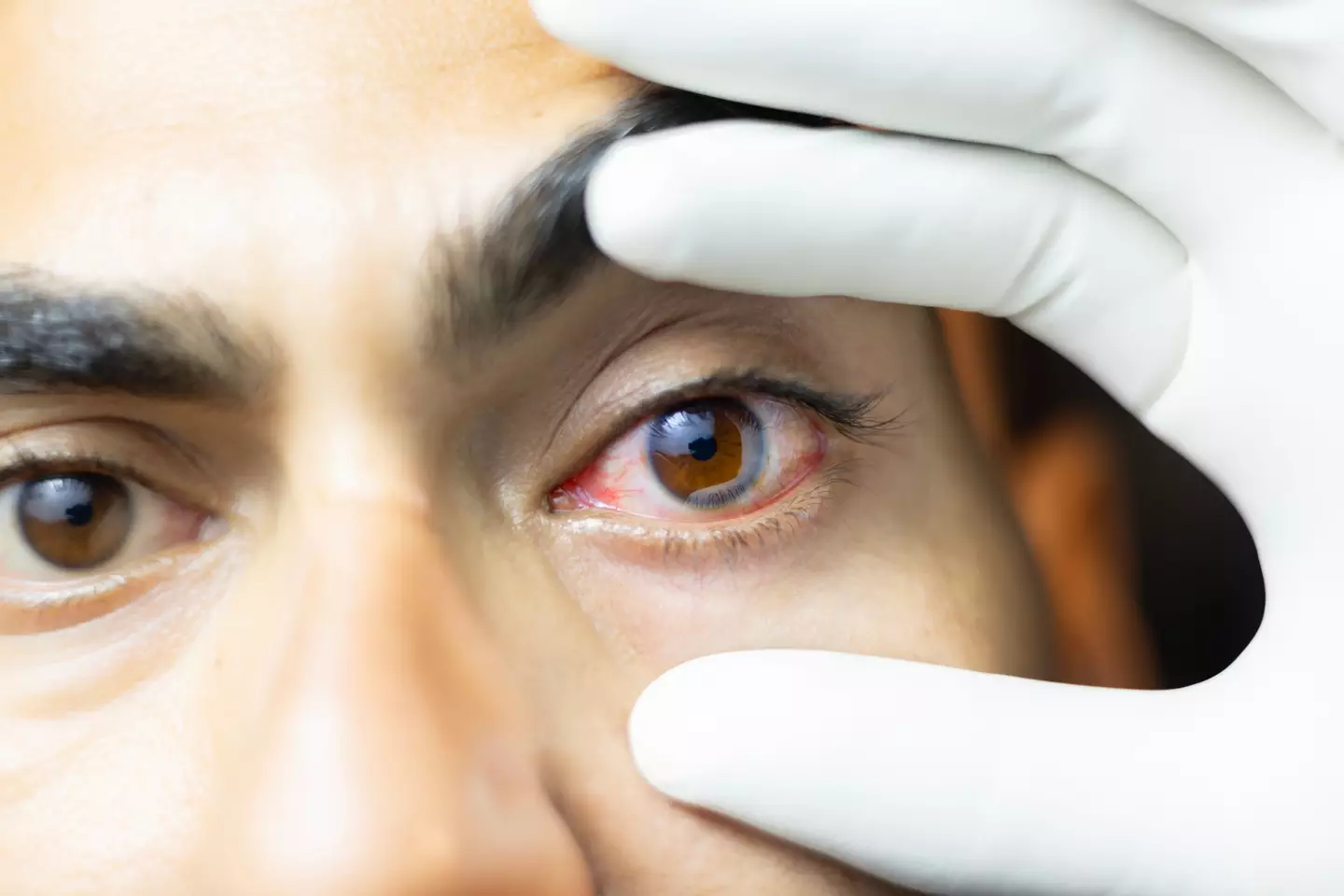 An eye doctor reiterated the importance of taking care of our eyes while on a podcast.(Getty Stock Image)