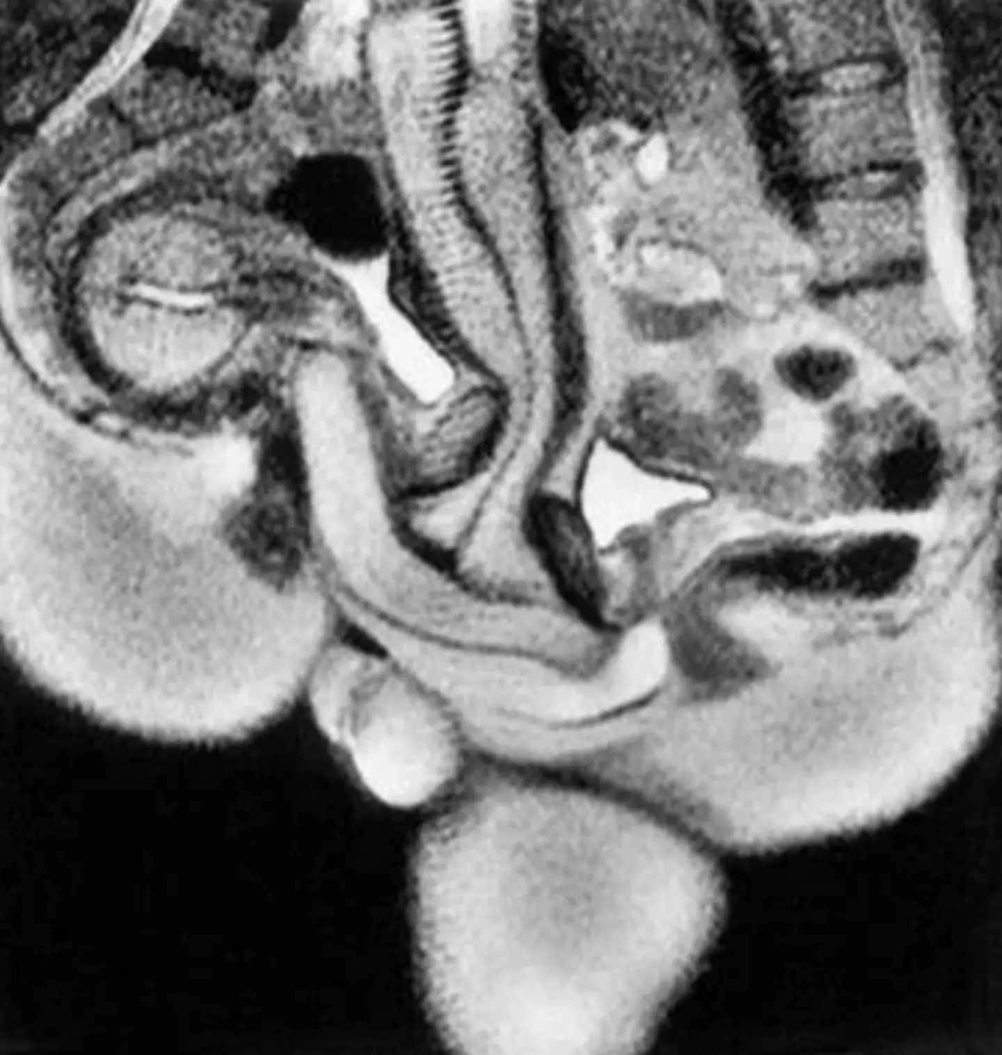The images were taken as part of a scientific study over 20 years ago in 1999.(The BMJ)
