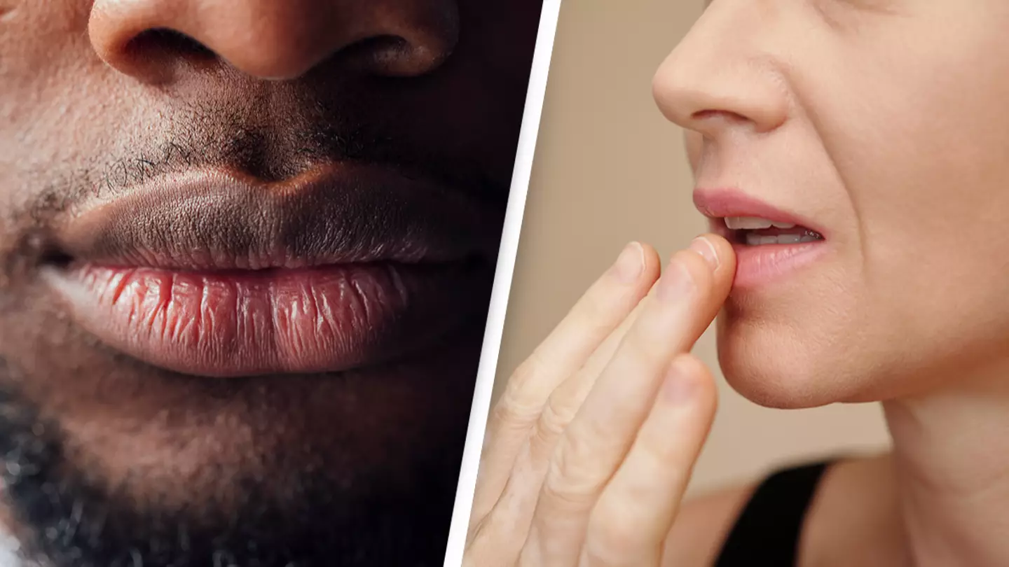 Doctors claim 'silent killer' condition could be spotted by 'strange' symptom lingering on lips
