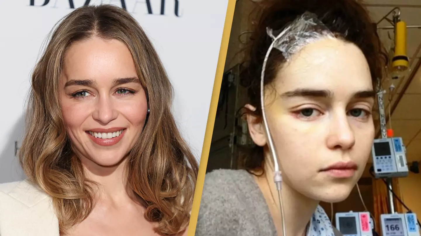 Game of Thrones star Emilia Clarke revealed she's missing ‘quite a bit’ of her brain after suffering two aneurysms