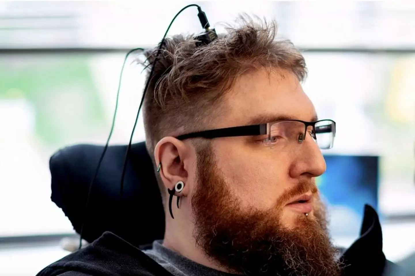 Company implants 50 people with brain chips to cure blindness, deafness and depression - UNILAD